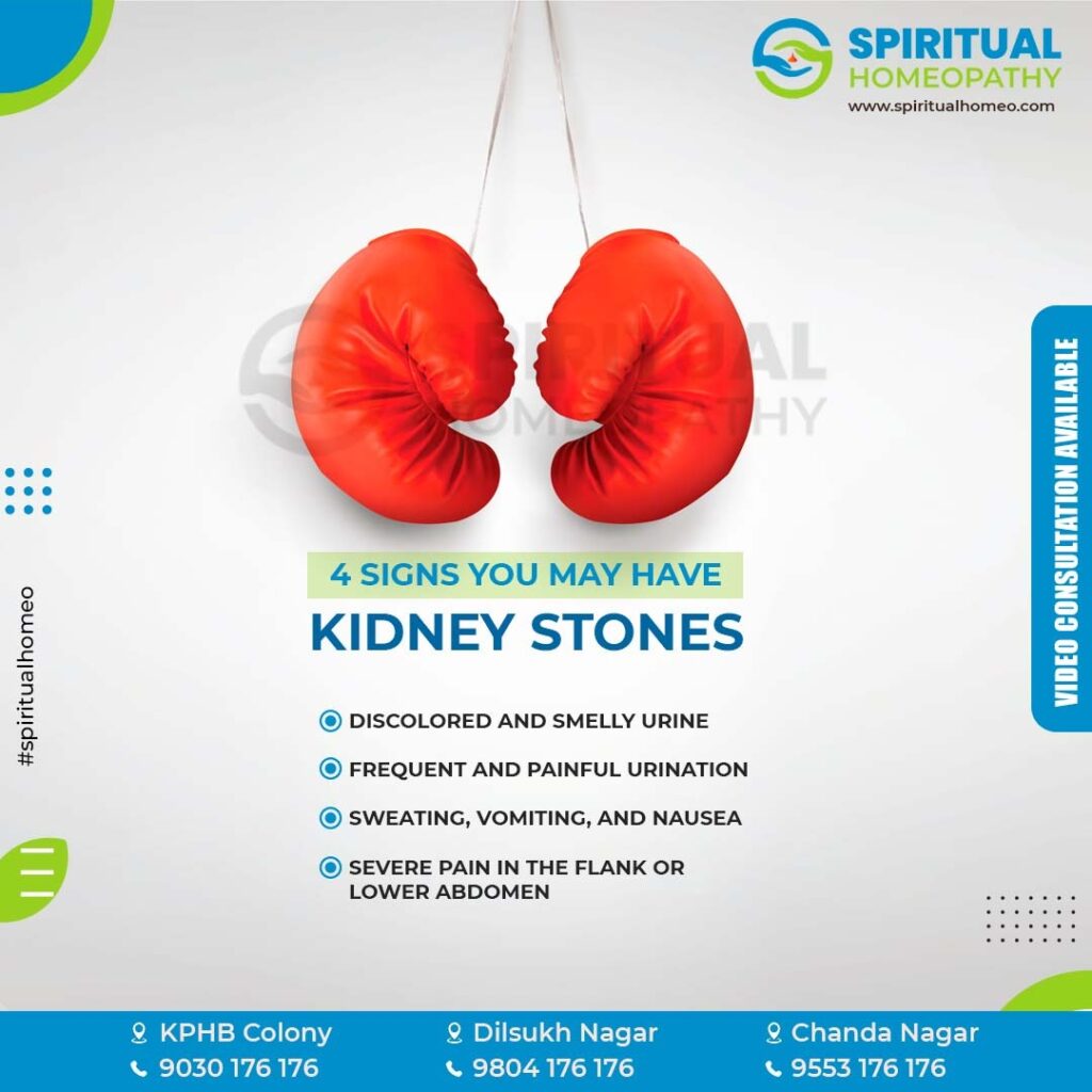 kidney-stones