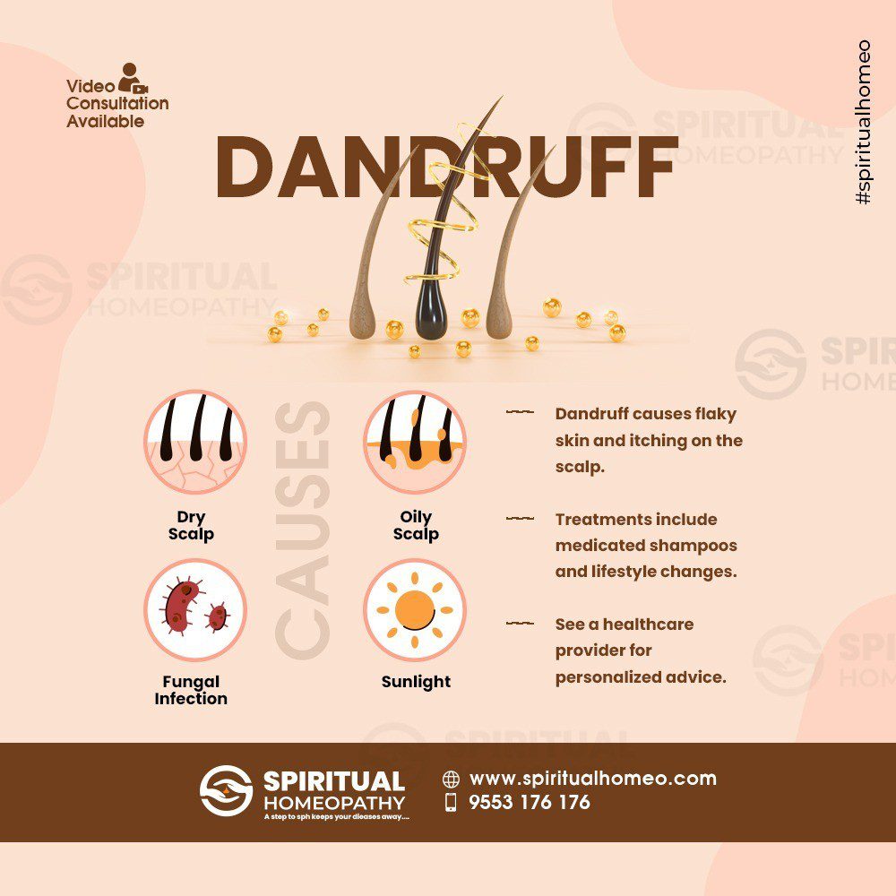 dandruff