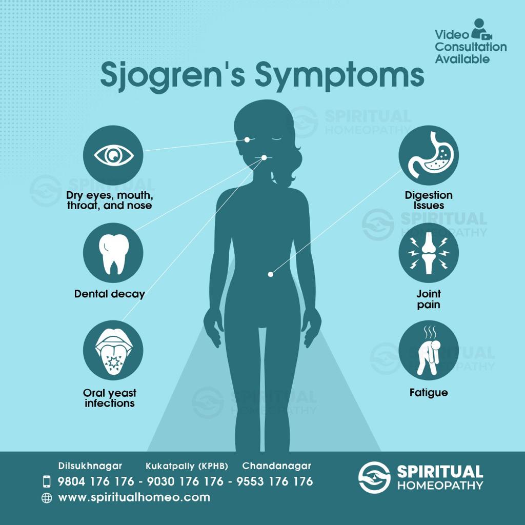 sjogren's symptoms