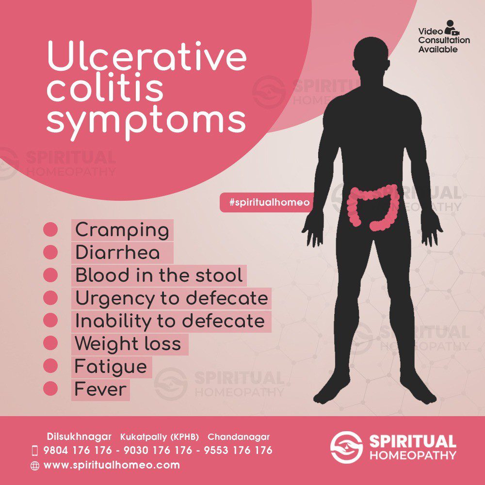 ULCERATIVE COLITIS