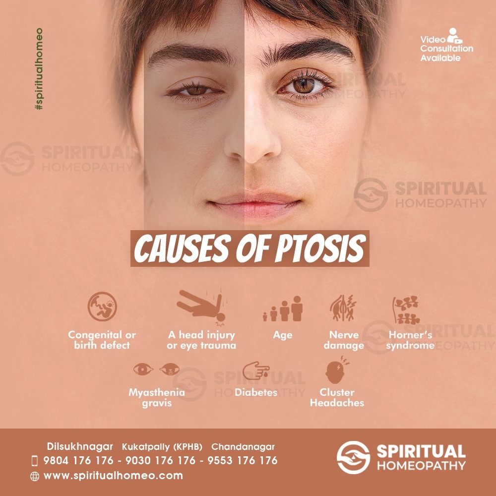 causes-of-ptosis