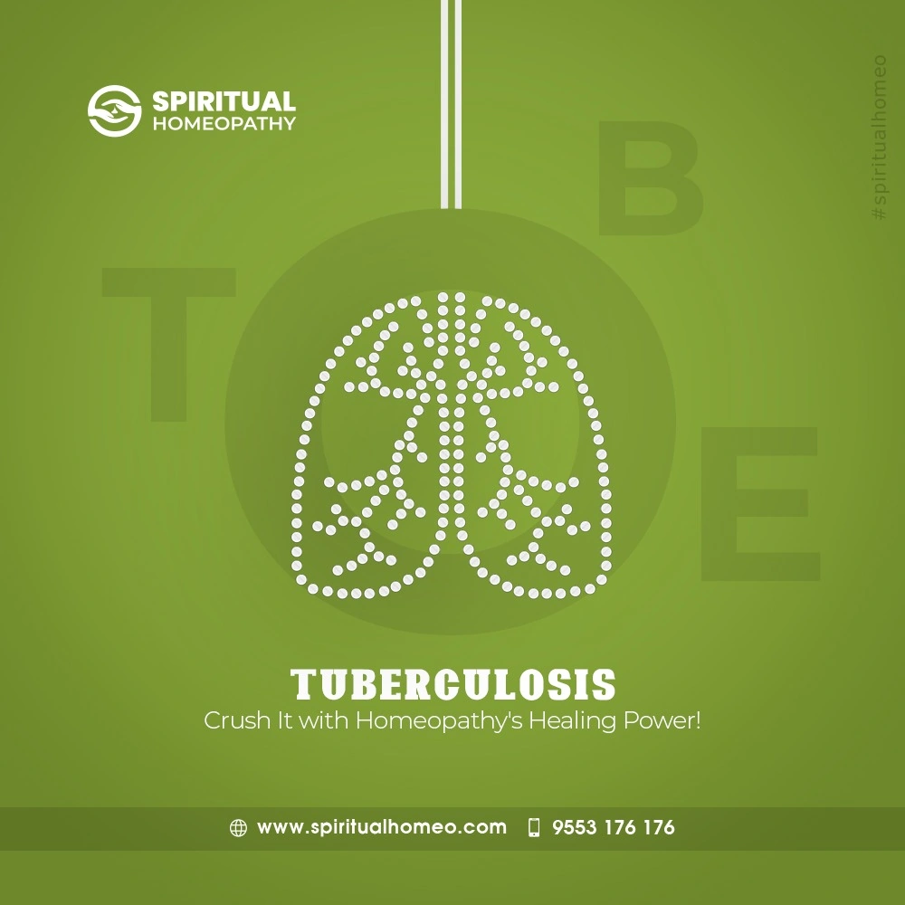 Tuberculosis
