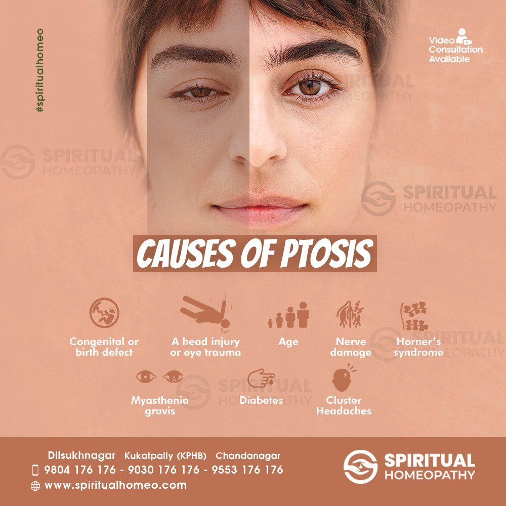 causes of ptosis