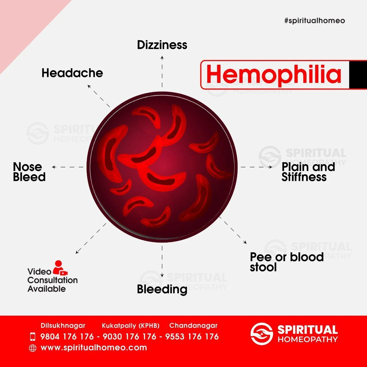 hemophilia