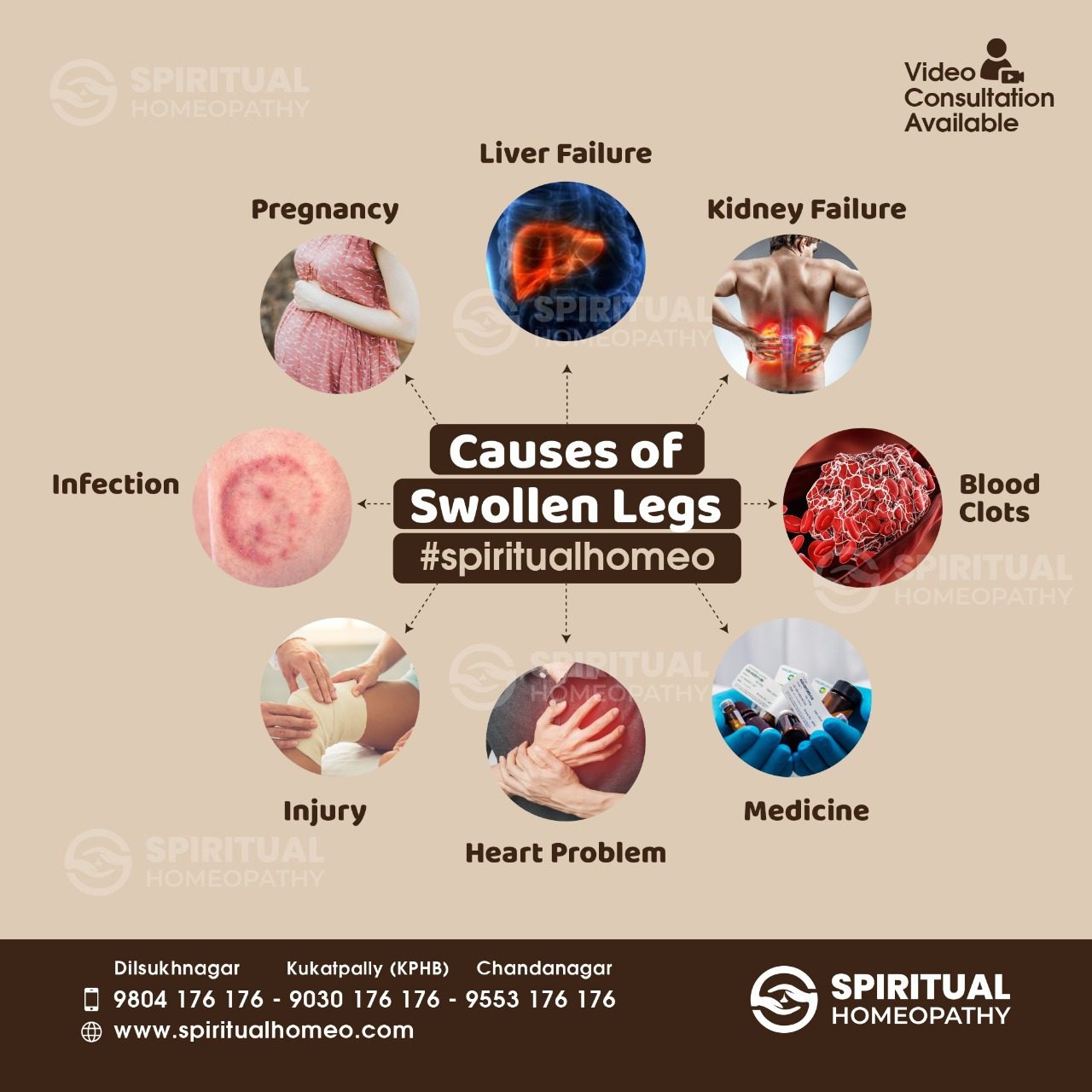 causes of swollen legs
