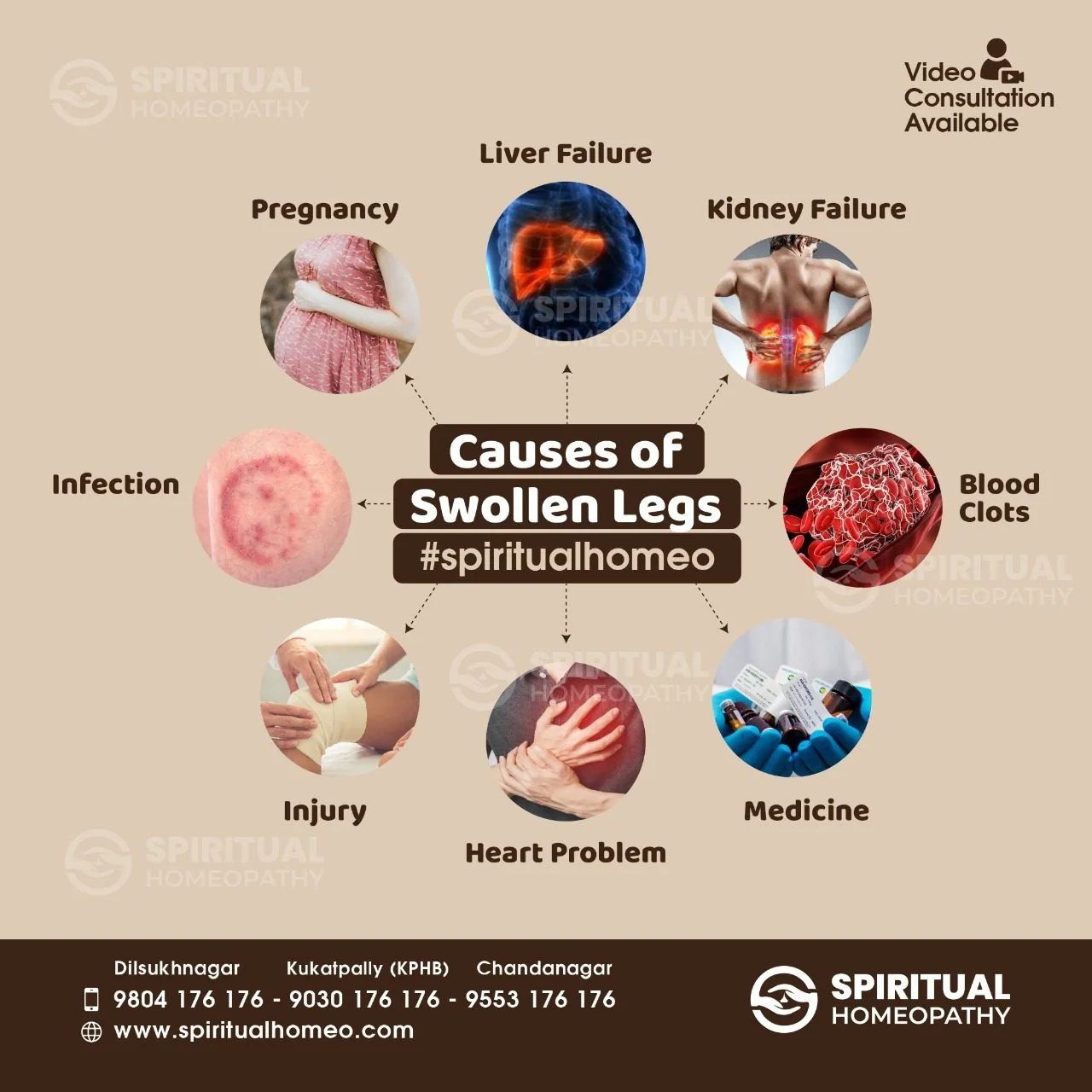 causes-of-swollen-legs