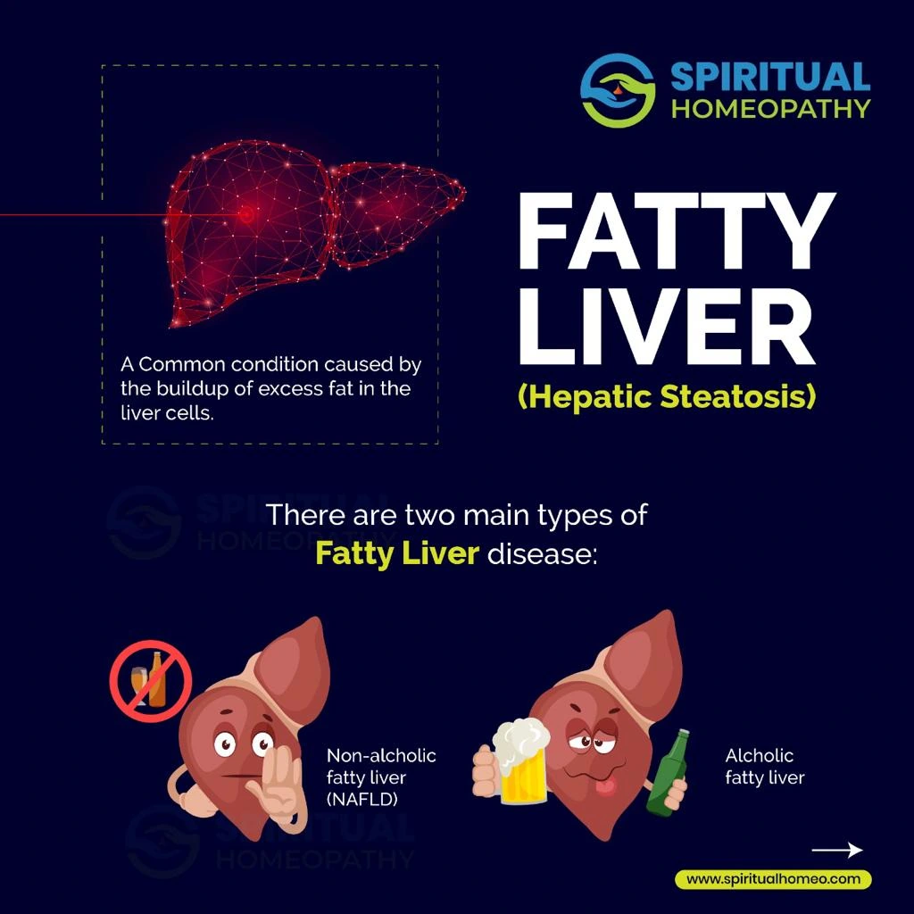 FATTY-LIVER