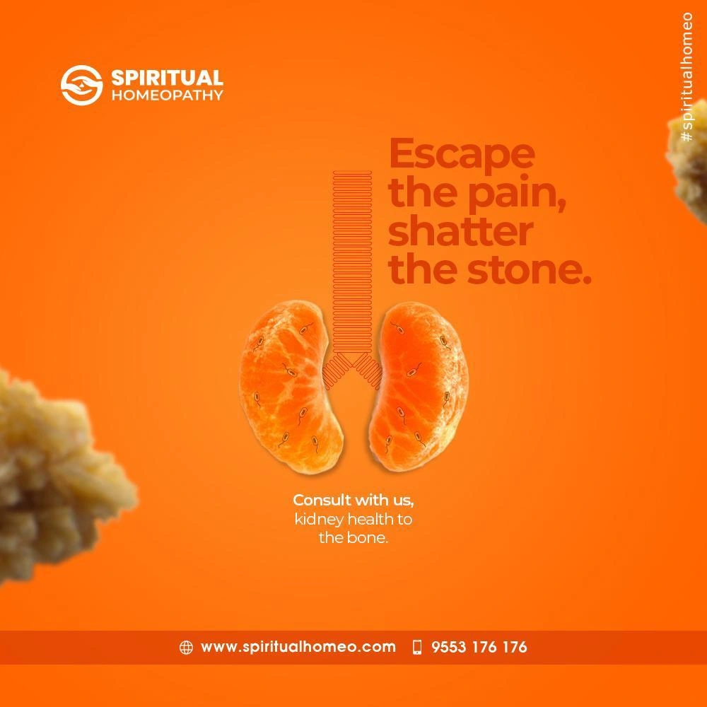 Kidney-Stone