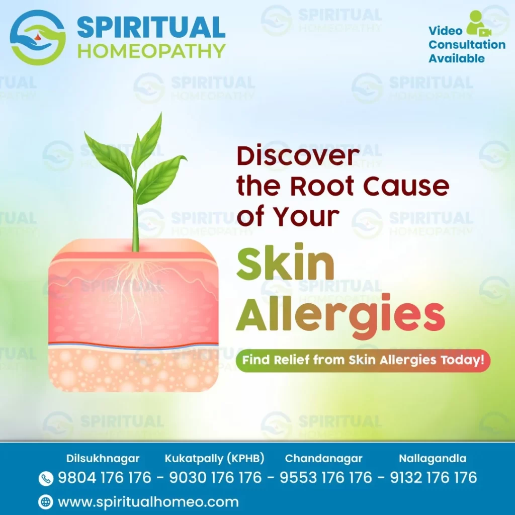 SKIN-ALLERGIES