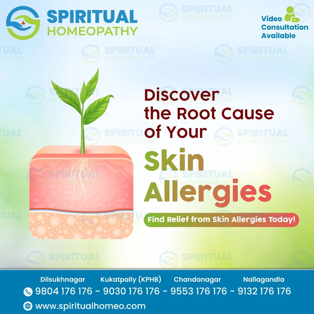 SKIN-ALLERGIES