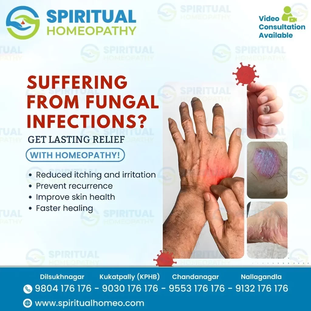 Fungal-Infections