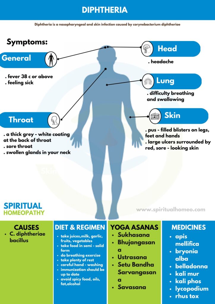 Diphtheria​