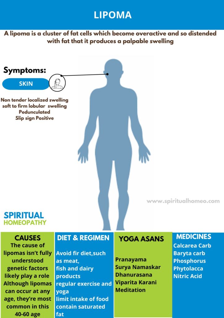 Homeopathic treatment for Lipoma