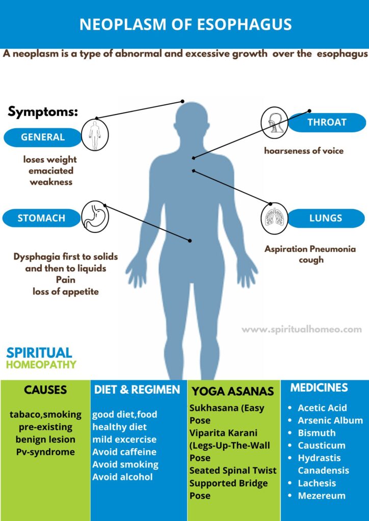 Neoplasm of Esophagus