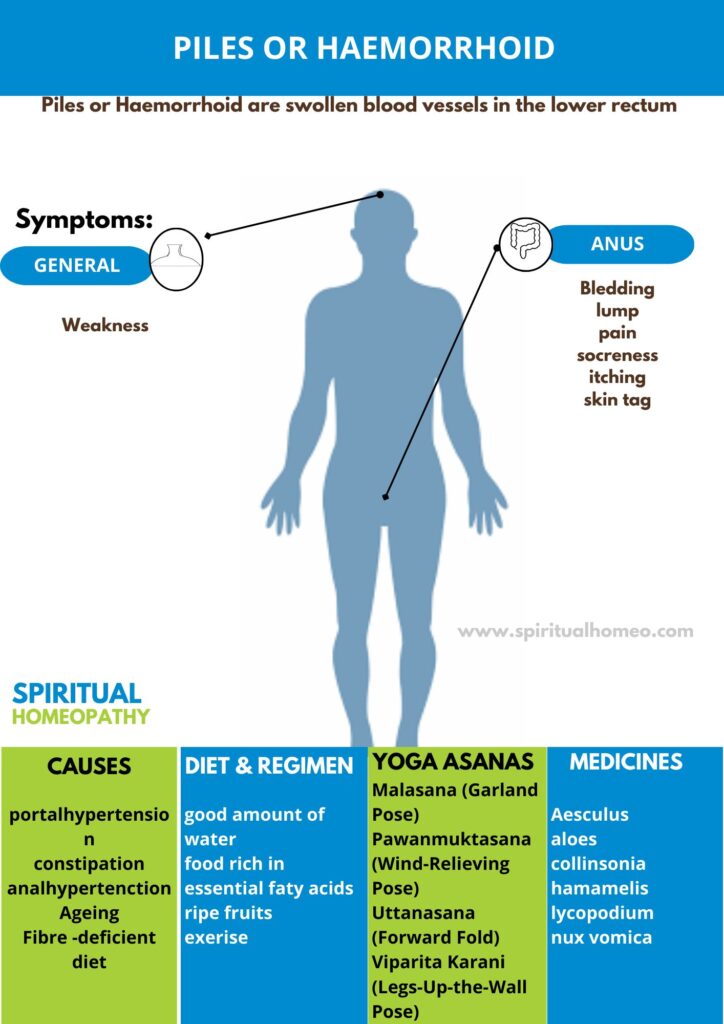 Homeopathic treatment for piles and haemorrhoid